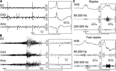 GABAA signaling, focal epileptiform synchronization and epileptogenesis